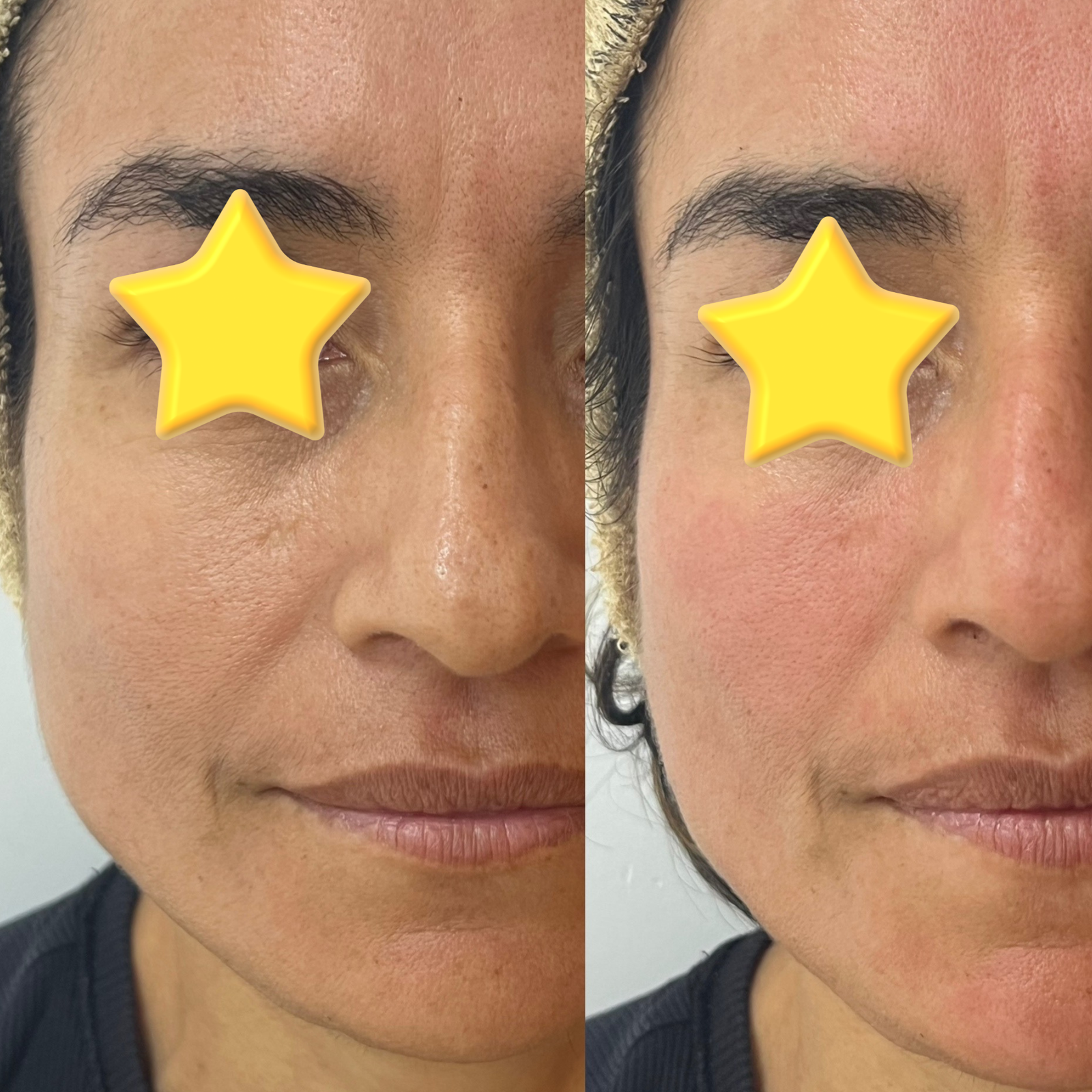 Sumaq Limpieza Profunda Antes y Después